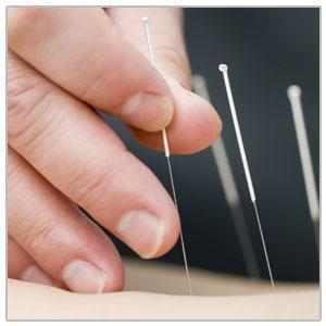 Intramuscular Stimulation (IMS) / Dry Needling - One Wellness